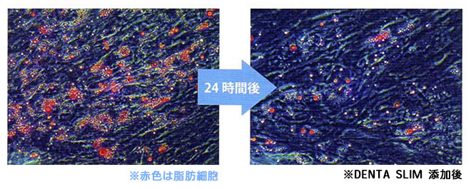DENTA SLIM脂肪細胞反応実験